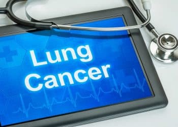 Lung cancer screening min 350x250 1