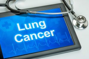 lung cancer screening 