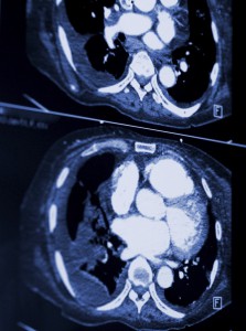 abnormal x-rays