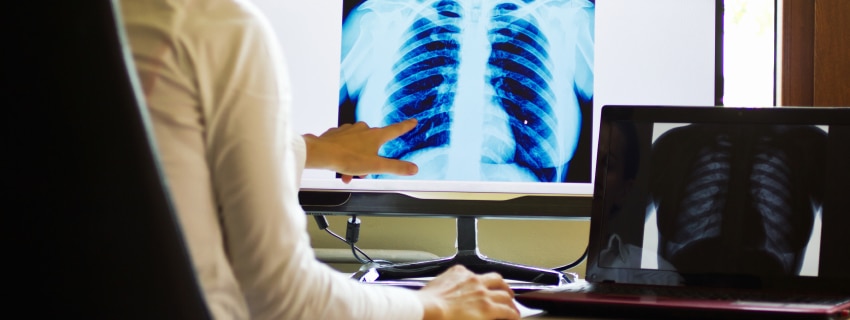doctor looking at and pointing to abnormal x-ray of patient’s chest on screen